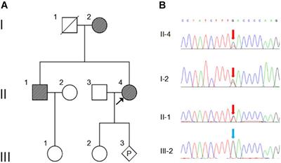 Identification of a Novel NOG Missense Mutation in a Chinese Family With Symphalangism and Tarsal Coalitions